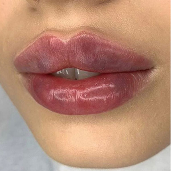 ژل لب روسی مدل خط دار