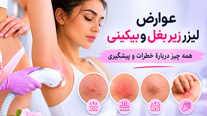 عوارض لیزر بیکینی