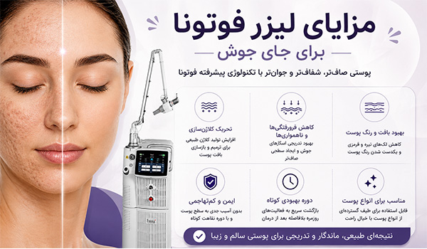 درمان جای جوش با لیزر فوتونا