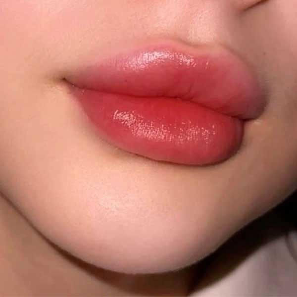 مرکز تزریق ژل لب در گوهردشت کرج