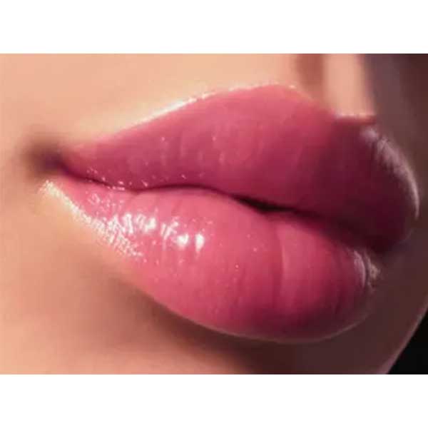 مرکز تزریق ژل لب در گوهردشت کرج
