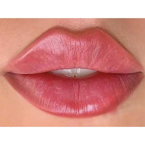 مرکز تزریق ژل لب در گوهردشت کرج