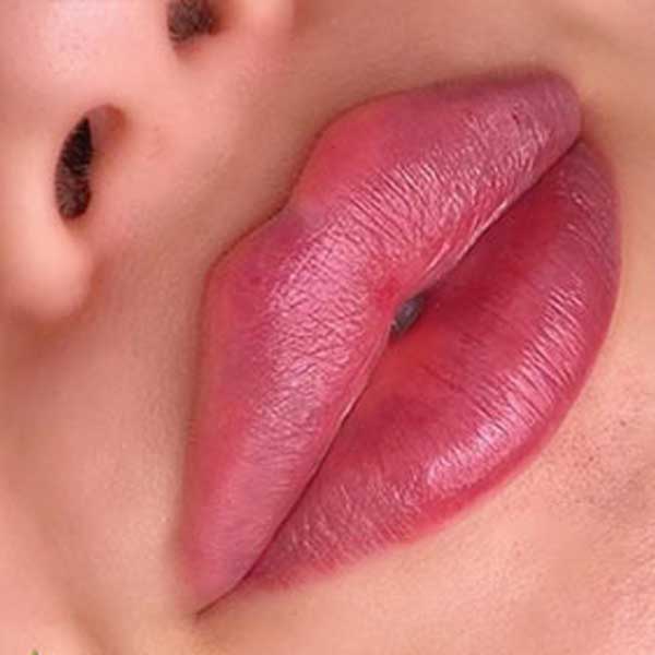 مرکز تزریق ژل لب در گوهردشت کرج