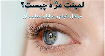 لمینت مژه چیست و چگونه انجام می‌شود؟