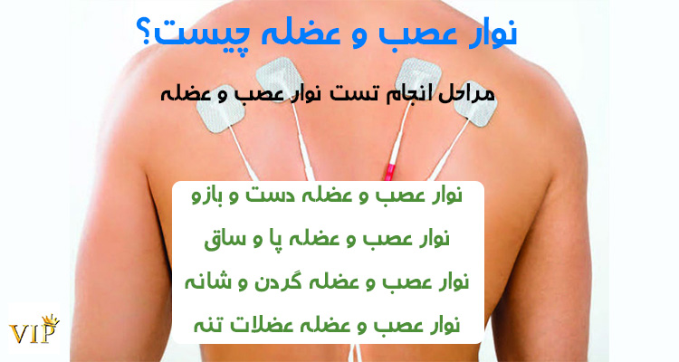 نوار عصب عضله چیست؟