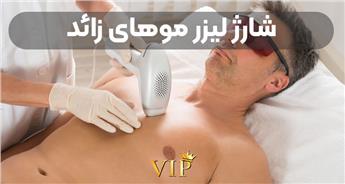شارژ لیزر موهای زائد چیست و چه زمانی به آن نیاز داریم؟