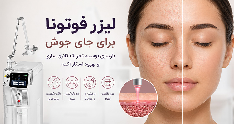 لیزر فوتونا برای جای جوش