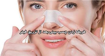 طریقه زدن چسب بینی بعد از تزریق فیلر و نکات مهم!