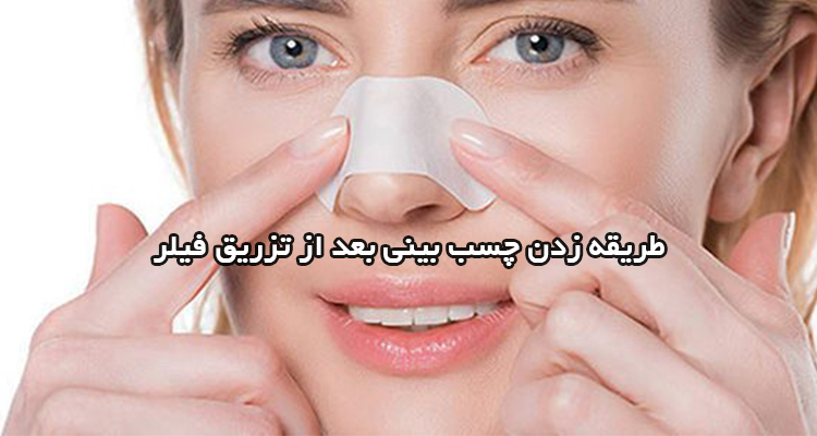 طریقه زدن چسب بینی بعد از فیلر