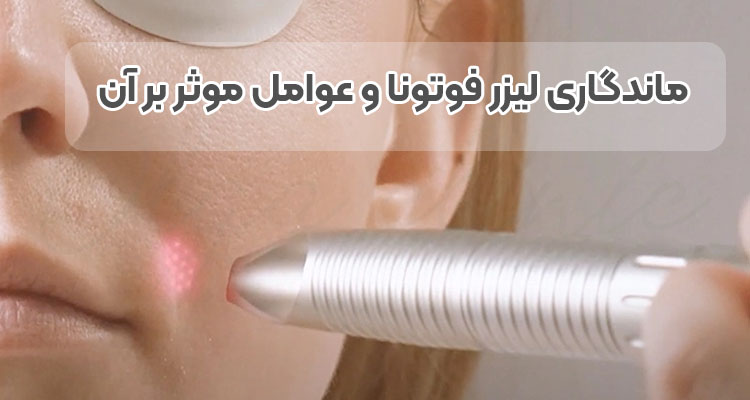 ماندگاری لیزر فوتونا