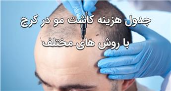 هزینه کاشت مو در کرج چقدر است؟ جدول قیمت 1404