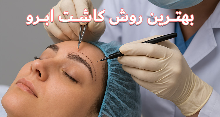 بهترین روش کاشت ابرو