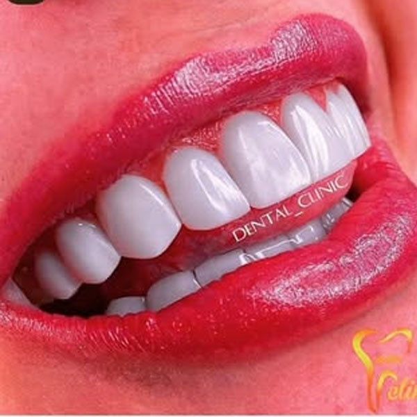 کلینیک دندانسازی عزیزی